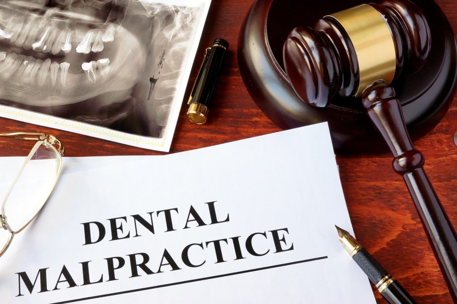 Frequently Asked Questions About Dental Malpractice Insurance